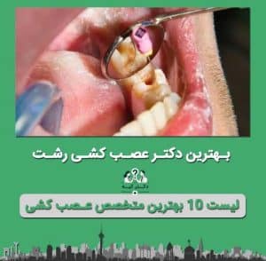 دکتر عصب کشی در رشت