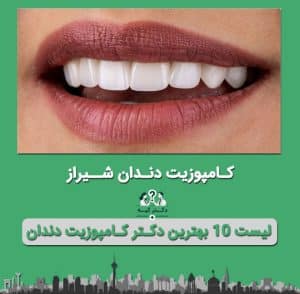 کامپوزیت دندان در شیراز