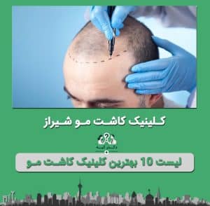کلینیک کاشت مو شیراز