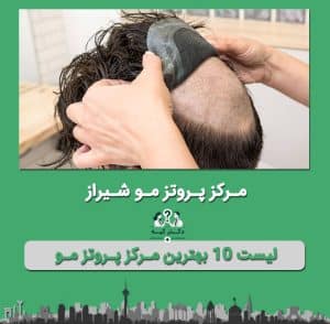 پروتز مو شیراز